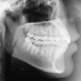 Radiologia Odontológica em Trindade - GO